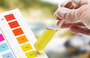 Καρκίνος του προστάτη: Γιατί το PSA μπαίνει ξανά στο μικροσκόπιο