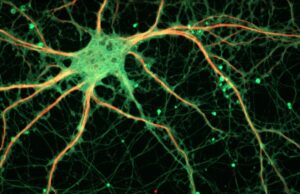 Εγκέφαλος: Μυστηριώδεις βλάβες του DNA εμπλέκονται στον σχηματισμό αναμνήσεων