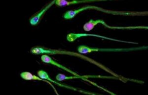 Μικροπλαστικά ανιχνεύονται πλέον ακόμα και στους ανθρώπινους όρχεις