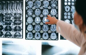 Αλτσχάιμερ: Μελέτη προτείνει νέα γενετική μορφή της νόσου