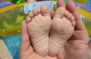 Γιατί ζαρώνουν τα δάχτυλά μας στο νερό; Υπάρχει λόγος