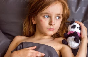 Η ιλαρά δεν είναι απλώς επικίνδυνη – Προκαλεί… αμνησία στο ανοσοποιητικό σύστημα