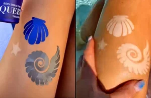 «Τατουάζ του ήλιου»: Η επικίνδυνη τάση του TikTok στη Γαλλία