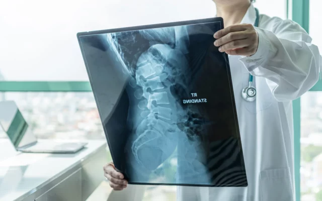 Νέα δεδομένα για τη Νωτιαία Μυϊκή Ατροφία Νέα δεδομένα για τη Νωτιαία Μυϊκή Ατροφία