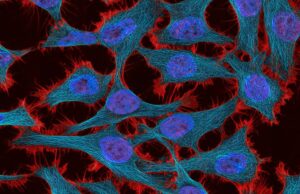 Αργεντινοί επιστήμονες φέρνουν επανάσταση στη χημειοθεραπεία