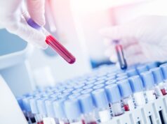 Αιματολογική εξέταση «ανιχνεύει» πάνω από 50 μορφές καρκίνου – Ελπίδες για έγκαιρη διάγνωση