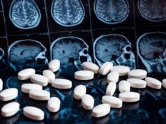 Απογοήτευση στις δοκιμές: τα φάρμακα GLP-1 δεν επιβραδύνουν την Αλτσχάιμερ