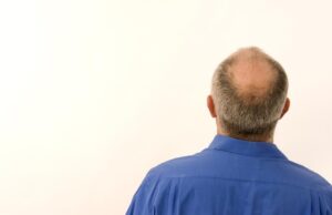 Ανακαλύφθηκε άγνωστος μηχανισμός τριχοφυΐας στο κεφάλι που υπόσχεται νέες μεθόδους φυσιολογικής ανάπτυξης μαλλιών