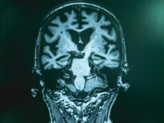 Τα «ζωντανά» όνειρα και άλλα 3 ύπουλα συμπτώματα της Πάρκινσον, χρόνια πριν εκδηλωθεί το «τρέμουλο»