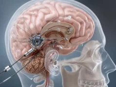 Neuralink: Μαζική παραγωγή εγκεφαλικών εμφυτευμάτων από το 2026 υπόσχεται ο Έλον Μασκ