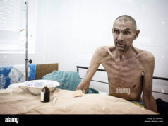 HIV/AIDS το 2025: Η «ξεχασμένη» επιδημία που επιστρέφει στην Ευρώπη