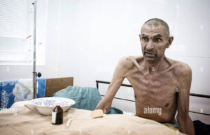 HIV/AIDS το 2025: Η «ξεχασμένη» επιδημία που επιστρέφει στην Ευρώπη