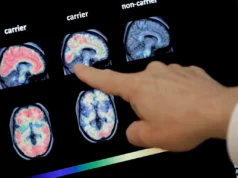 Μελέτη αποκαλύπτει σύνδεση μεταξύ καρκίνου και Αλτσχάιμερ