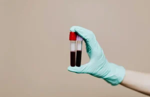 Απλή εξέταση αίματος προβλέπει ποιοι θα ζήσουν περισσότερο, δείχνει νέα έρευνα