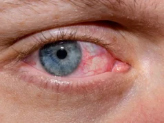 Ο αμφιβληστροειδής αποκαλύπτει πιθανή σύνδεση βακτηρίου με το Αλτσχάιμερ