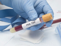 Ο δείκτης PSA και ο καρκίνος του προστάτη: τι πρέπει να γνωρίζουν οι άνδρες